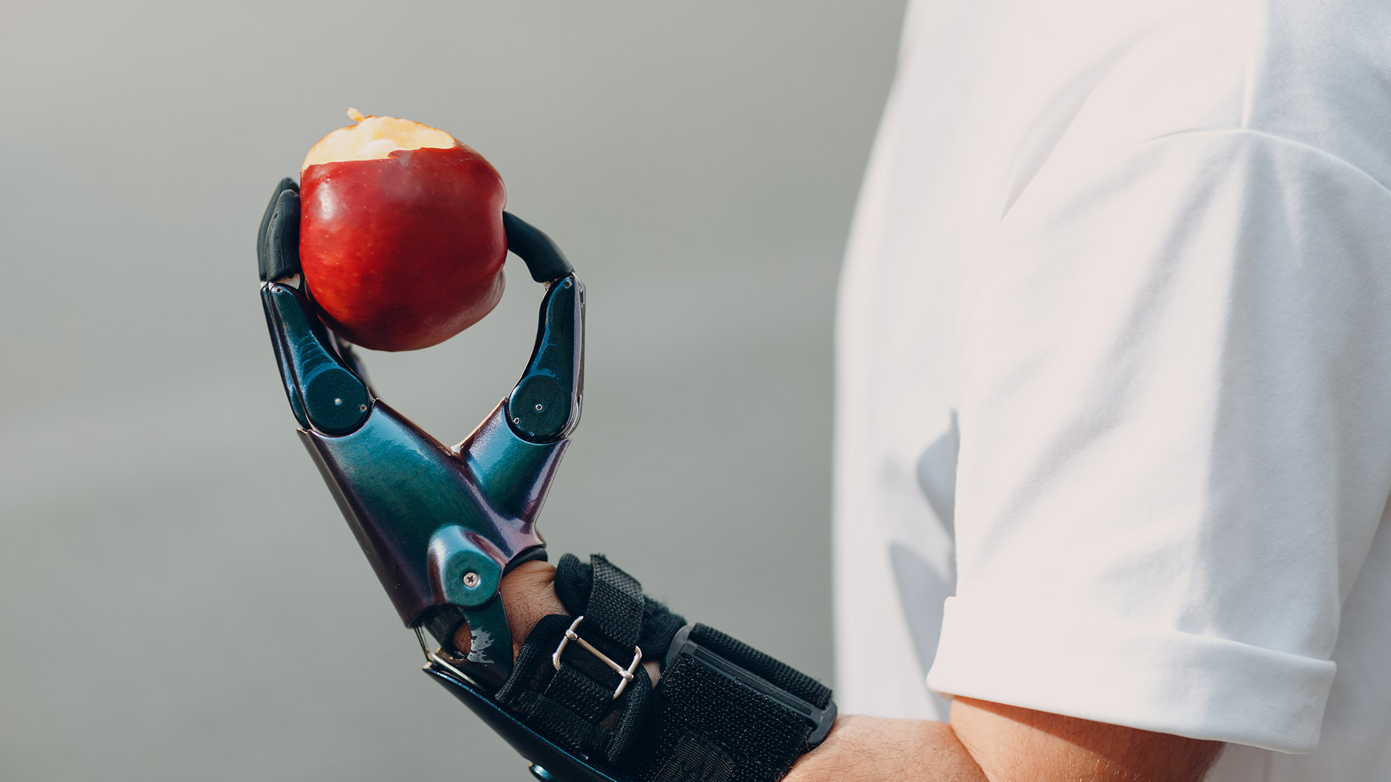 A man with a prosthetic hand holds a bitten apple in it 