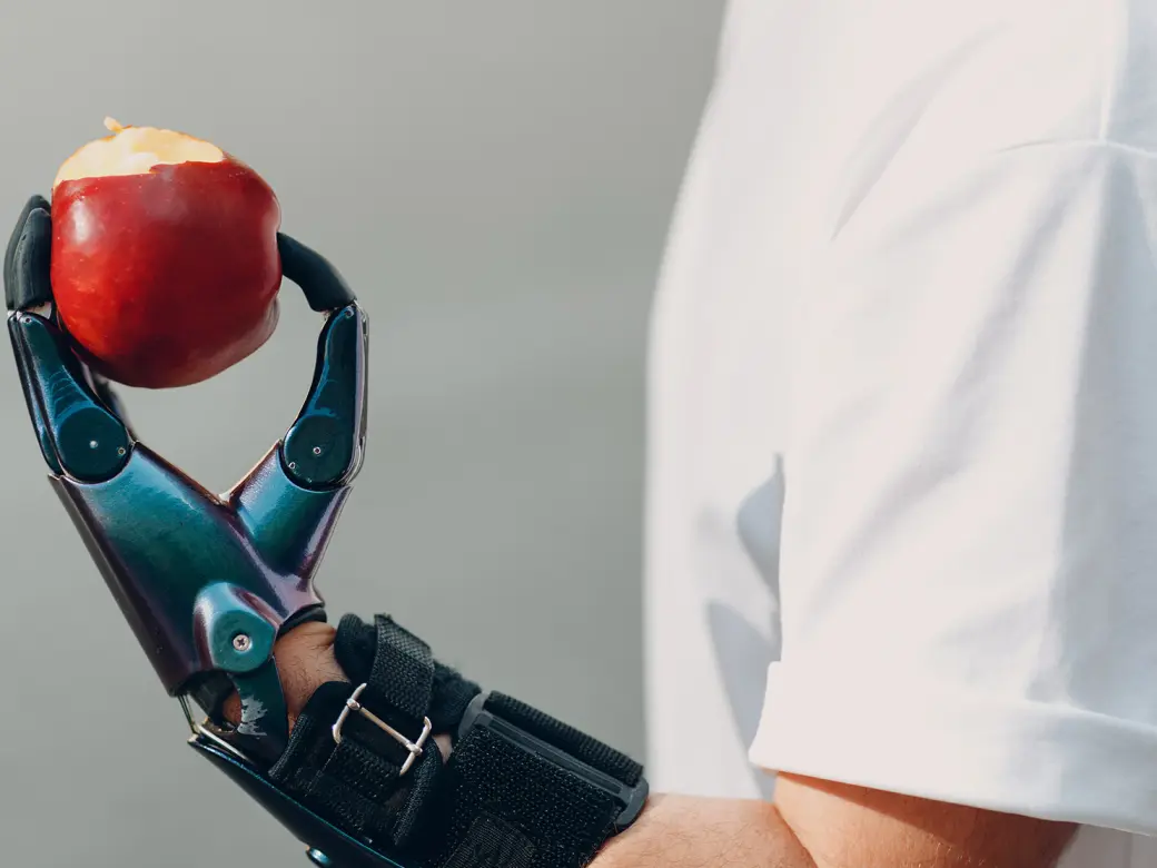 A man with a prosthetic hand holds a bitten apple in it 